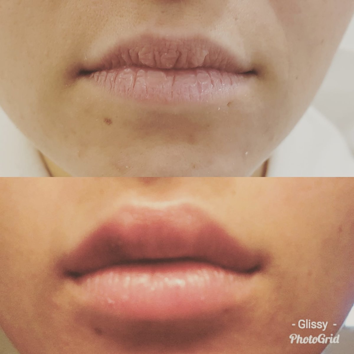 Lippenbehandlung im Glissy Kosmetikstudio